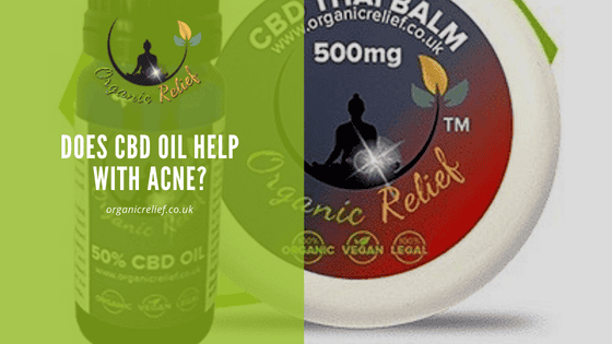 Does CBD Oil help with acne?